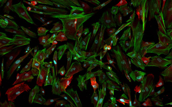 Пироговский университет: как мозг борется с Альцгеймером и Паркинсоном